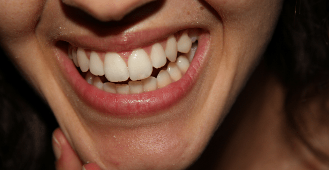 Flickr / Matteo Martinello