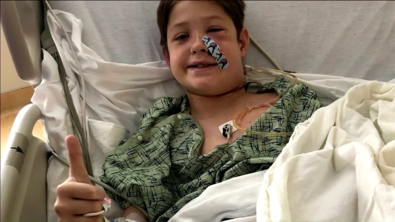 10-Year-Old Boy Survives After Falling Face First On Metal Meat Skewer