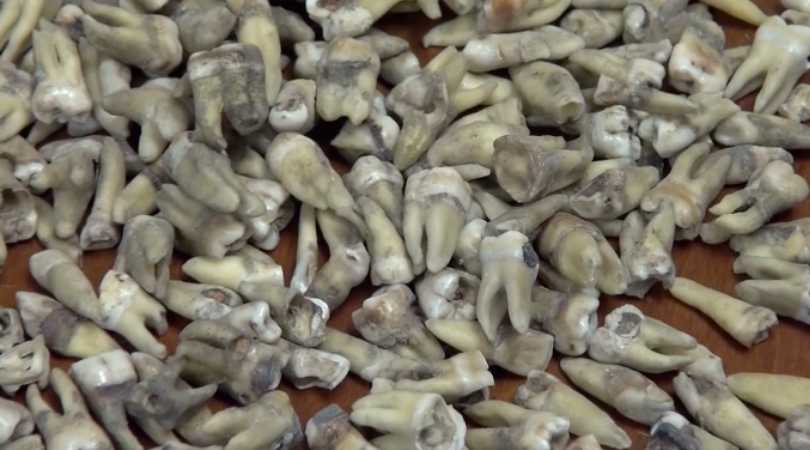 Construction Workers Find Nearly 1,000 Human Teeth Inside Wall