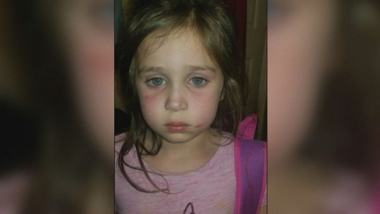"Whole Bus Ride Was Complete Torture": 5-Year-Old Girl Attacked on School Bus By 12-Year-Old Bully