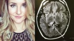 Nurse Diagnoses Her Own Brain Tumor After Seeing Posters at Work