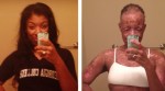 Woman's Skin 'Melts Off' After Doctors Prescribed Wrong Medication