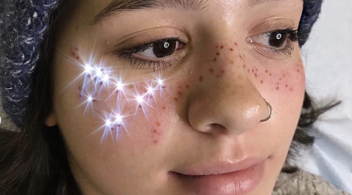 SemiPermanent Freckle Tattoos The Ultimate Guide