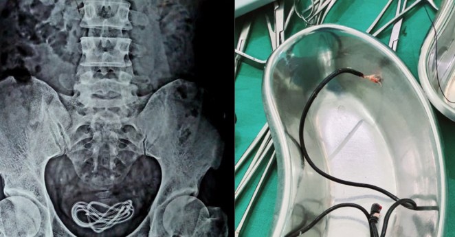 Indian Man Phone Charger Penis