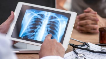 Man Was Suffering From Chest Pains, Doctors Surprised By What's Been In His Torso For Years