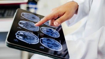 Huntington's Disease Successfully Treated For First Time