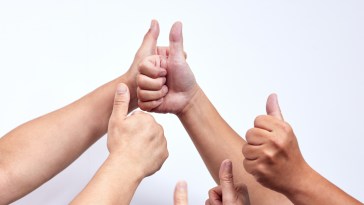 Man Born Without Thumbs Isn't Letting Anything Stop Him Says People Are Amazed He Can Play Guitar