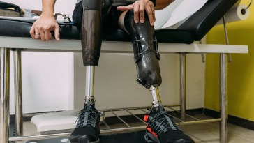 20-Year-Old Man Loses Both His Legs Days Before Birthday