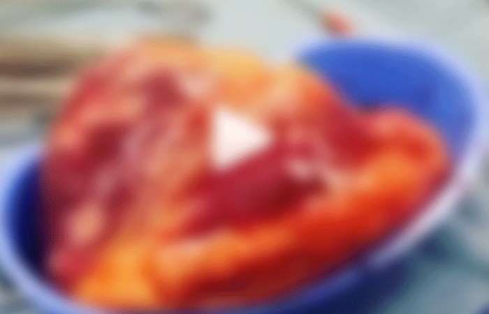 WATCH: This Heart Is 3X Normal Size Due to Cocaine Abuse