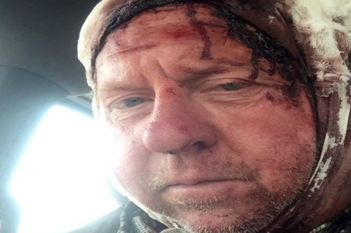 A bear gave this bow hunter more than he bargained for, and he has the scars to prove it