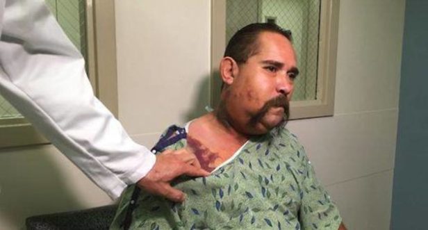 Arizona Man Bit on the Face Attempting to Barbecue a Rattlesnake