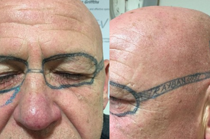 A Man’s ‘Friends’ Tattooed Glasses on Him After He Passed Out Drunk