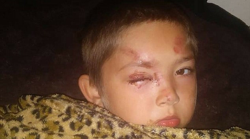 6-Year-Old Boy Hospitalized After Defending Friend Against Bullies