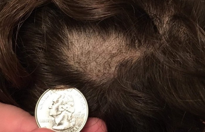 Parents Upset After Chunks of Hair Were Taken From Students For Random Drug Testing