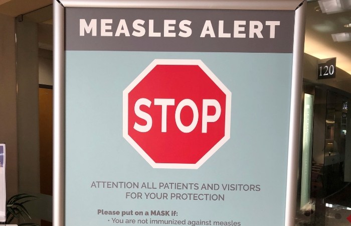 Patients in Northwest Measles Outbreak Traveled to Hawaii and Oregon After Being Exposed