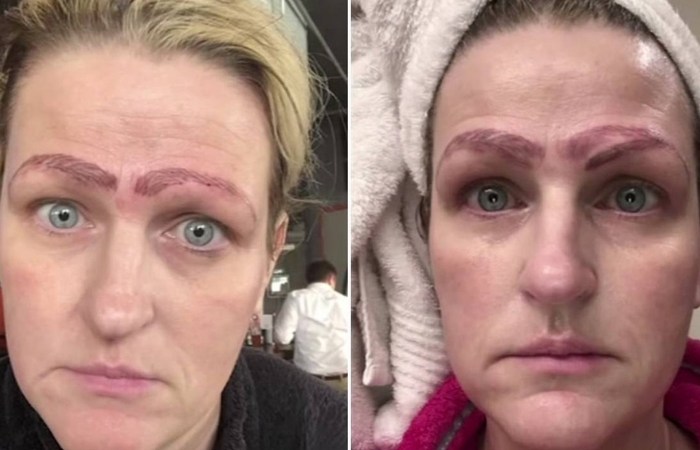 Woman Left With 4 Eyebrows After Botched Microblading Procedure