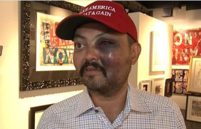 NYC Art Gallery Owner Attacked For Wearing ‘Make America Great Again’ Hat