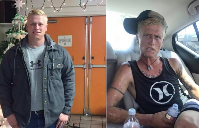 Mom Shares Haunting Before and After Photos of Her Addicted Son