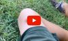 Nail Gun Accident Video