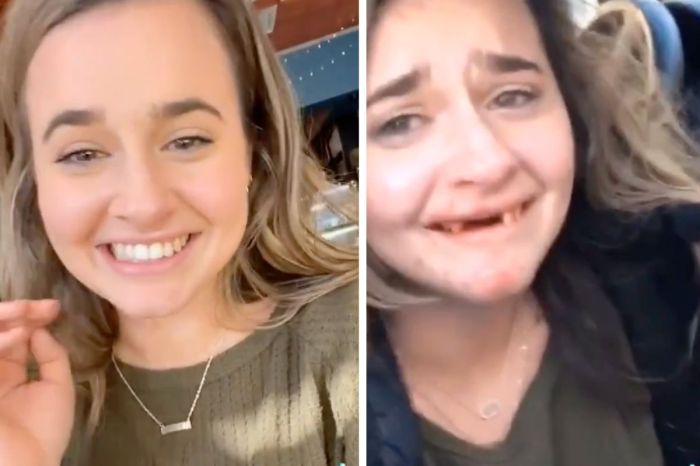 Woman Tragically Knocks Out Her Front Teeth After ‘Too Many Mimosas’