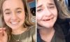 Woman Tragically Smashes Out Her Front Teeth After ‘Too Many Mimosas’